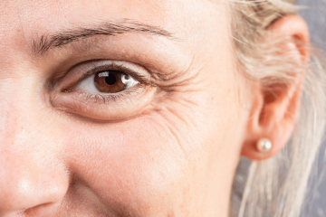 Close-up of mature woman’s eye area showing fine lines and wrinkles.